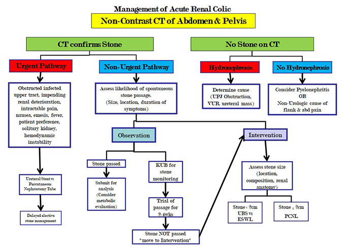 Algorithm for the management of acute flank pain.