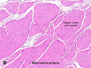 American Urological Association - Urinary Bladder: Muscularis Propria