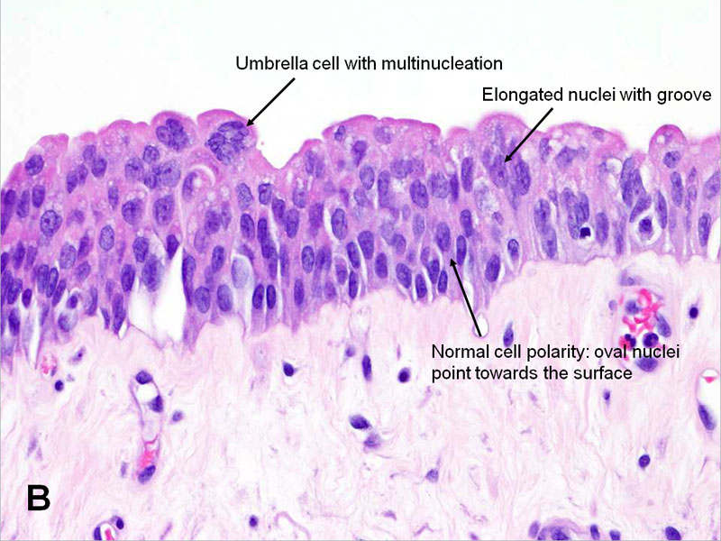 American Urological Association Urinary Bladder Normal Urothelium