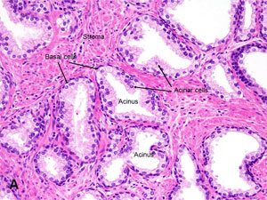 American Urological Association - Prostate