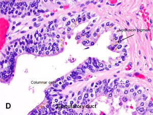 American Urological Association - Seminal Vesicles