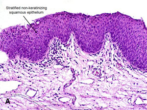 American Urological Association - Penile Urethra