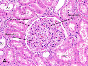 American Urological Association - Kidney: Renal Corpuscle (Glomerulus)